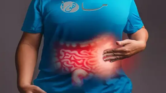 اعراض القولون العصبي
